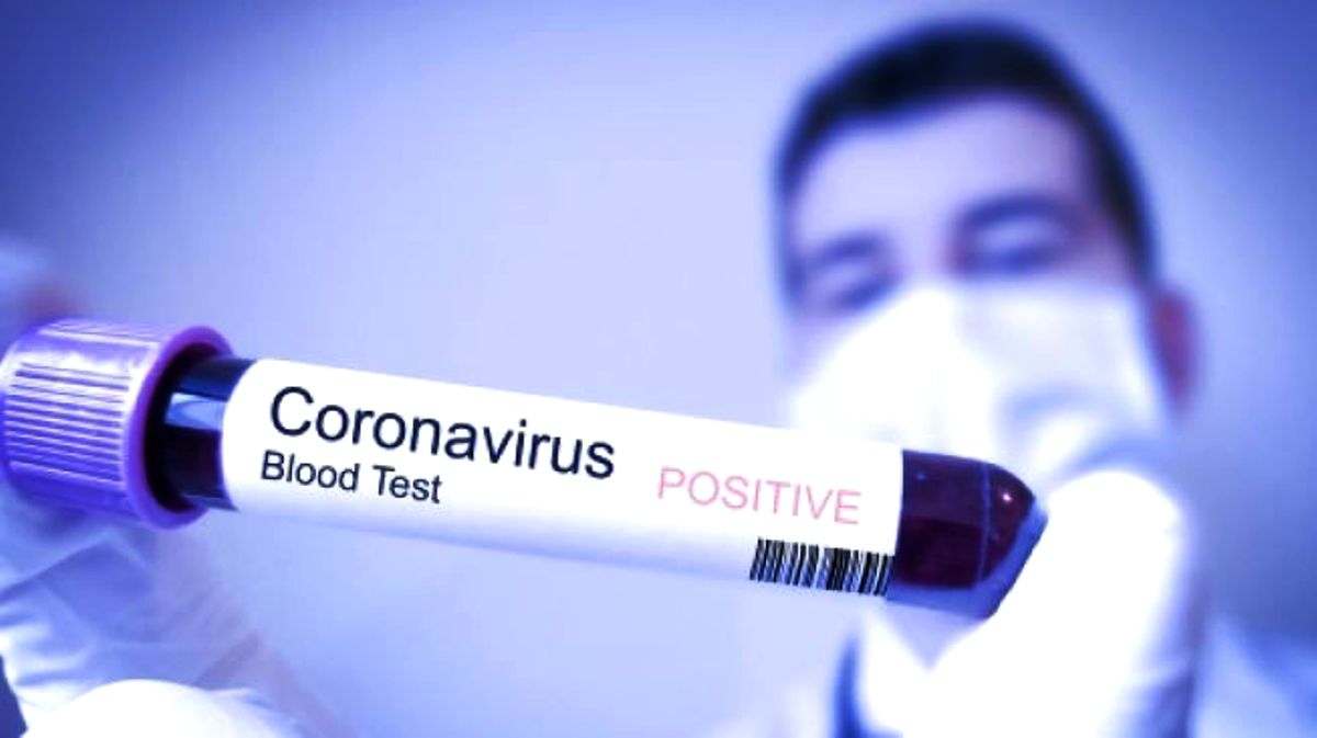 Surati Rumah Sakit dan Puskesmas, Kotamobagu Siaga Masuknya Virus Corona